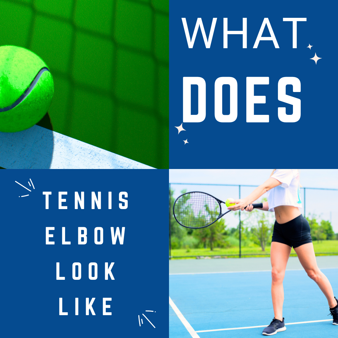 What does tennis elbow look like